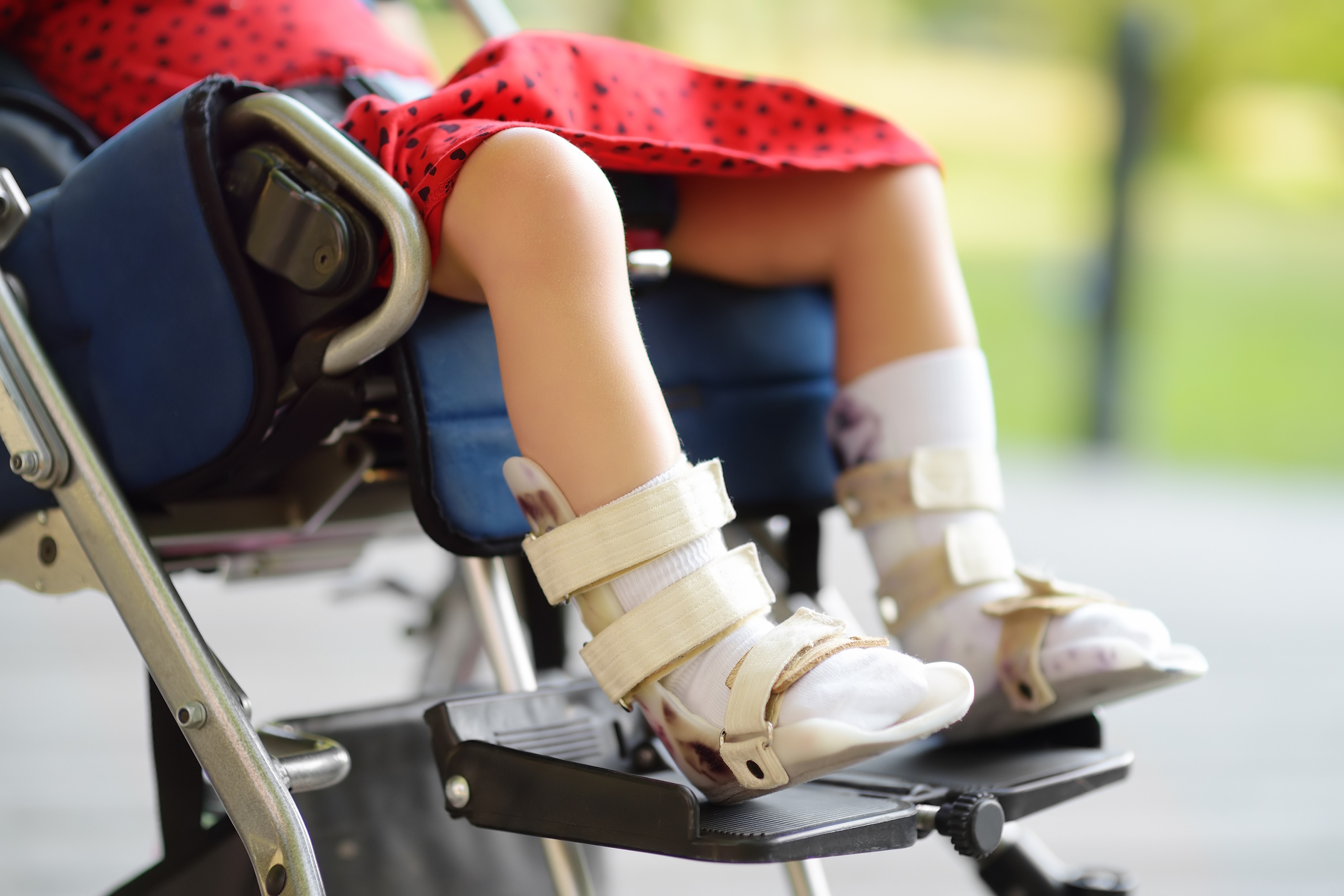 Child with Cerebral Palsy injury in a wheelchair