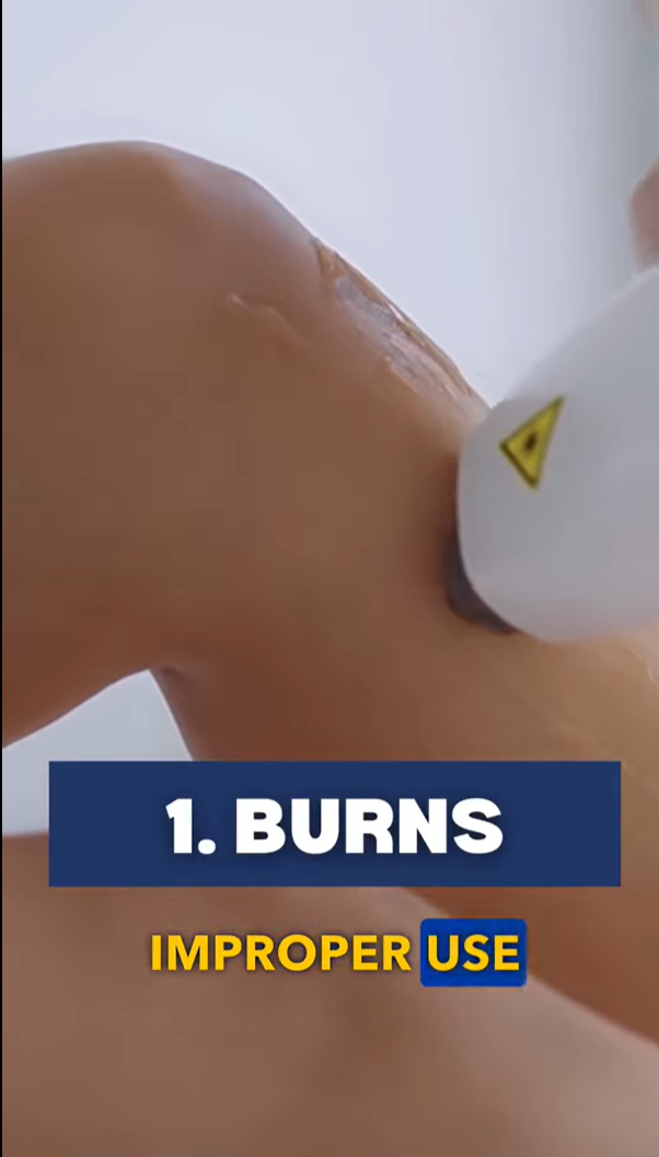 What Are Some Common Injuries From Laser Hair Removal?